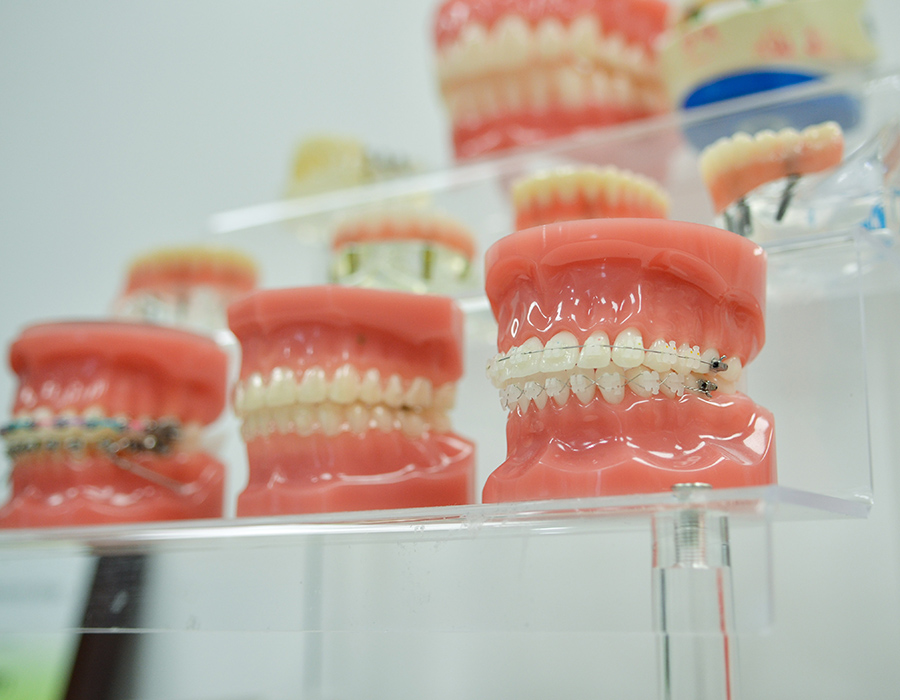 Porcelain Braces West Covina CA