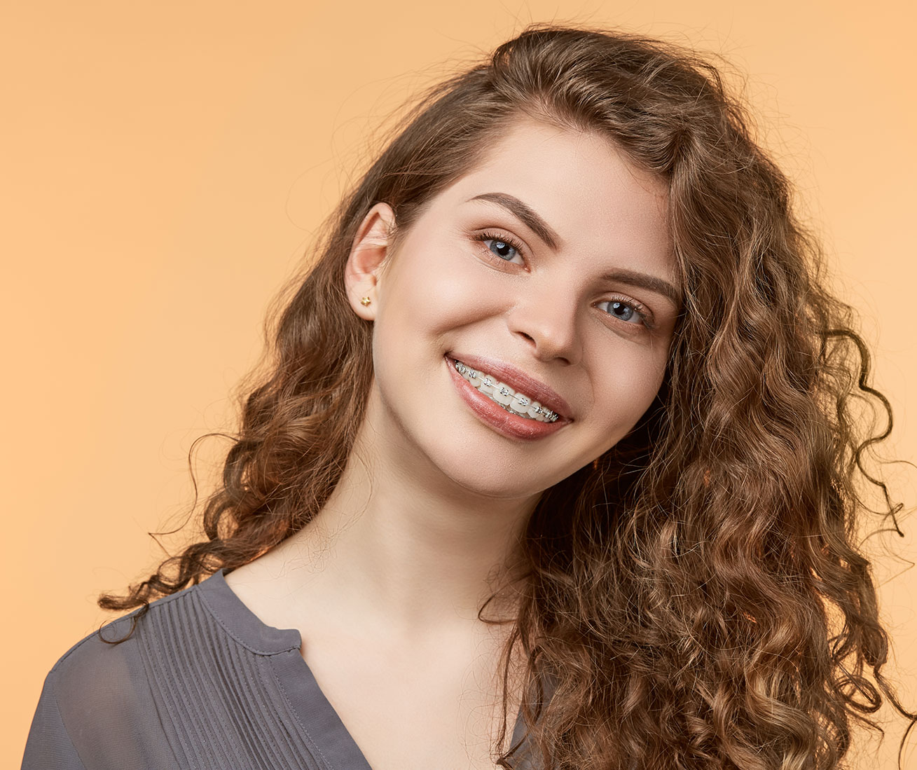Ceramic Braces West Covina CA