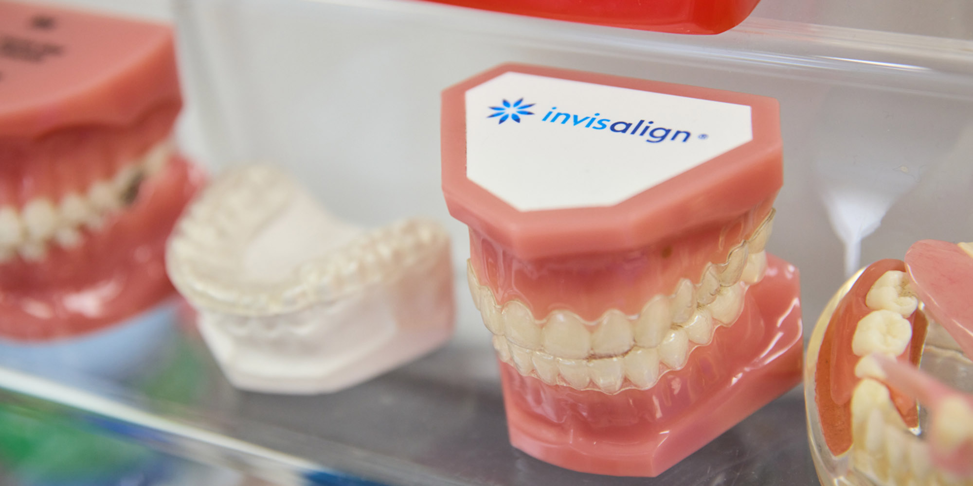 How Long Do You Need To Wear InvisalignⓇ Clear Braces West Covina CA