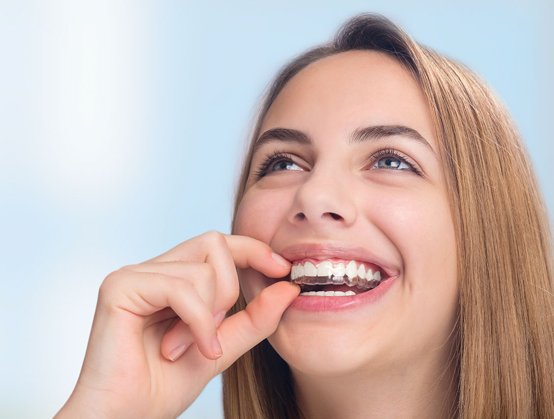 Invisible Braces West Covina CA