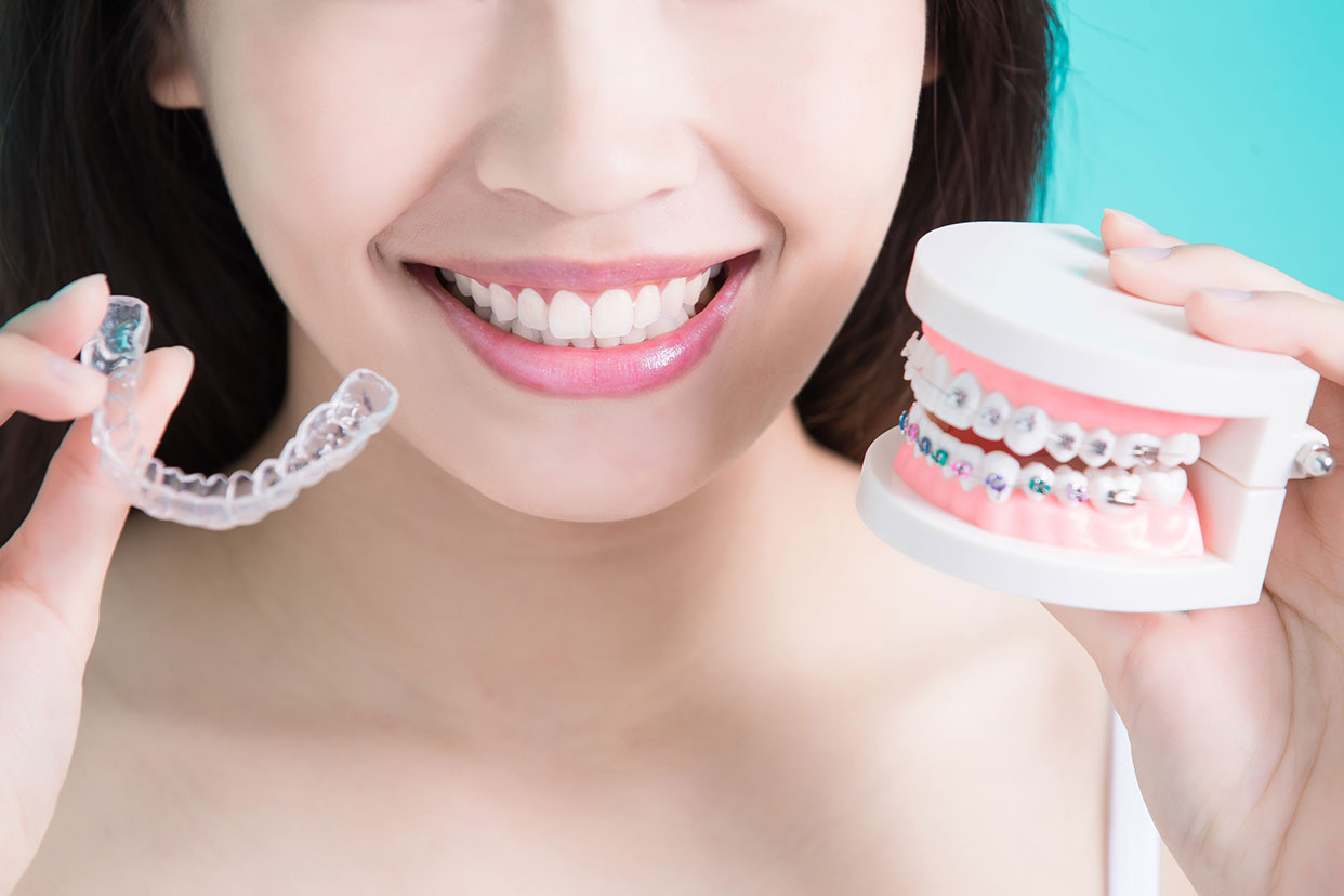 Orthodontist Near Me West Covina CA